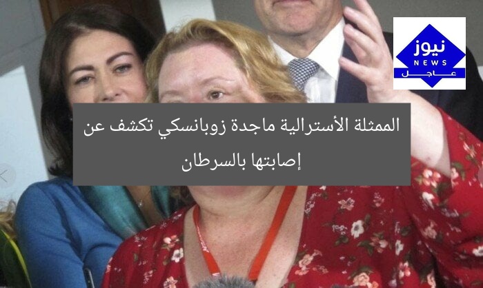 الممثلة الأسترالية ماجدة زوبانسكي تكشف عن إصابتها بالسرطان