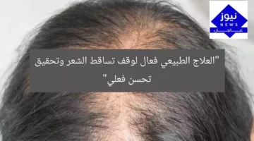 “العلاج الطبيعي فعال لوقف تساقط الشعر وتحقيق تحسن فعلي”