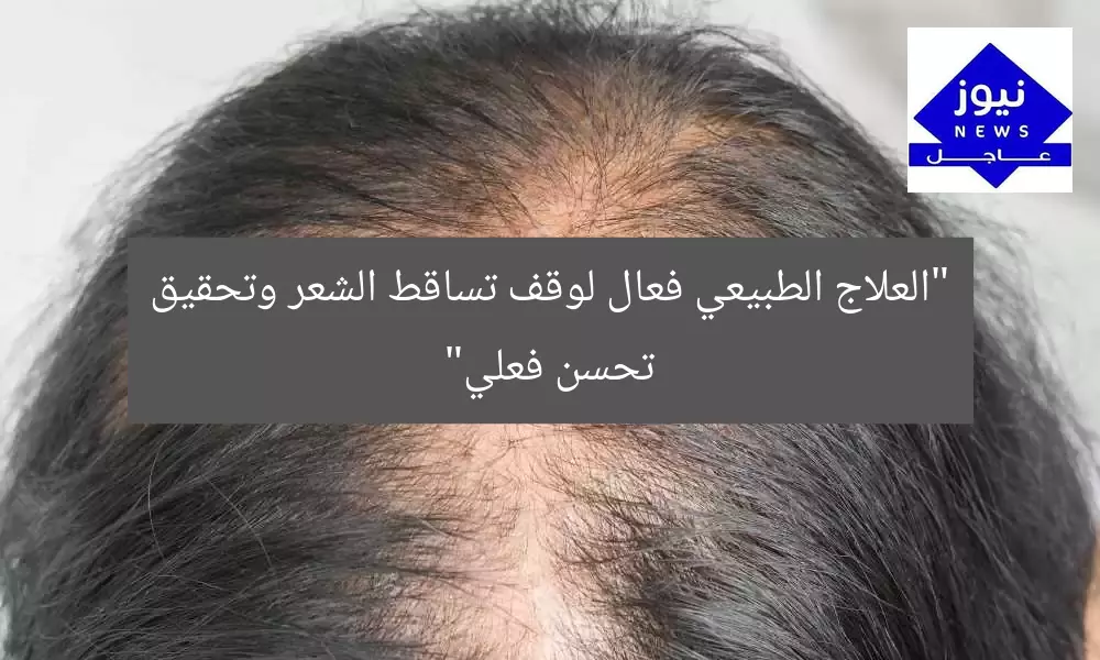 “العلاج الطبيعي فعال لوقف تساقط الشعر وتحقيق تحسن فعلي”