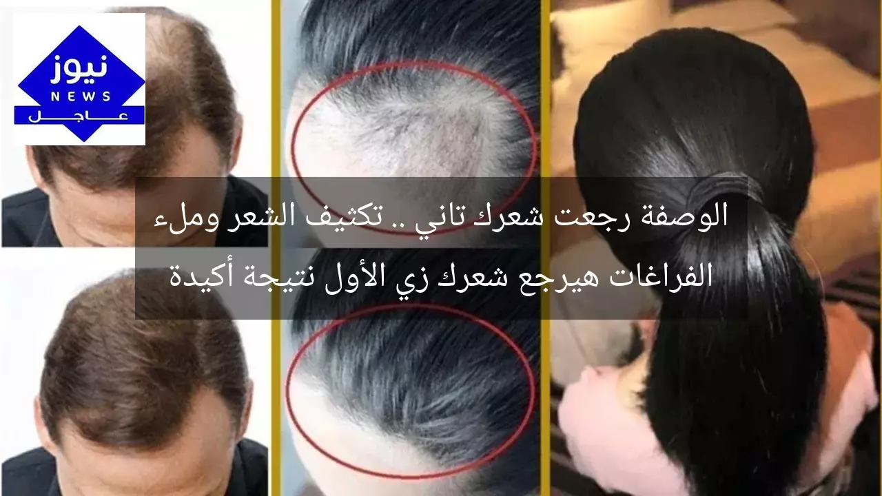 الوصفة رجعت شعرك تاني .. تكثيف الشعر وملء الفراغات هيرجع شعرك زي الأول نتيجة أكيدة