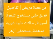 فريق طبي يستخرج تليفونًا من معدة مريض| تفاصيل مدهشة, مستشفى أزهر أسيوط, حالات طبية غريبة