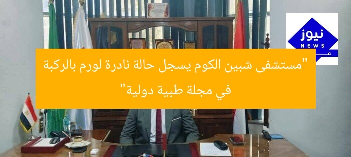 “مستشفى شبين الكوم يسجل حالة نادرة لورم بالركبة في مجلة طبية دولية”