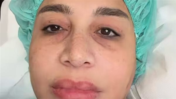 عاجل.. من داخل غرفة العمليات.. فيديو مؤثر لبسمة وهبة ورسالة قوية لمتابعيها