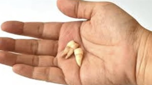 عاجل.. تفسير حلم سقوط الأسنان في المنام لابن سيرين.. دلالات الخير والشر