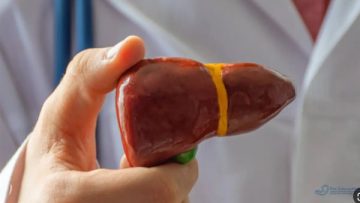 عاجل.. أطباء يؤكدون إمكانية علاج الكبد الدهني المبكر بتغيير نمط الحياة