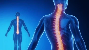 عاجل.. عاجل: المرض الصامت الذي يدمر عمود طفلك الفقري… ملايين المراهقين في خطر!