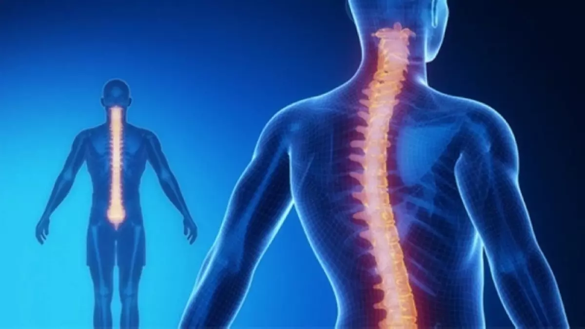 عاجل.. عاجل: المرض الصامت الذي يدمر عمود طفلك الفقري… ملايين المراهقين في خطر!