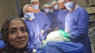 نجاح طبي جديد بمستشفيات جامعة بني سويف لعلاج فتق ضخم