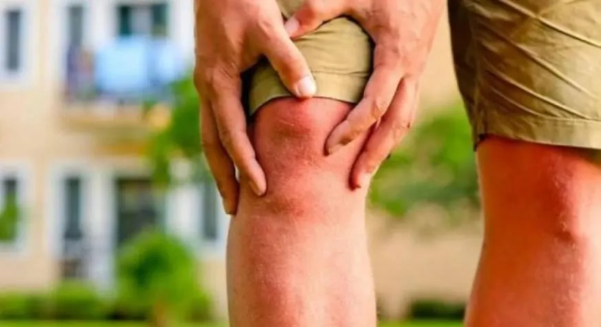 علاج جديد محتمل لتجديد غضاريف الركبة قد يقلل الحاجة لجراحة استبدال المفصل وفق دراسات أولية