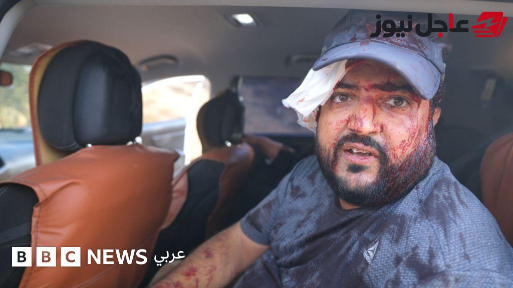 إصابة فلسطينيين وصحفية أمريكية خلال حصاد الزيتون في الضفة الغربية