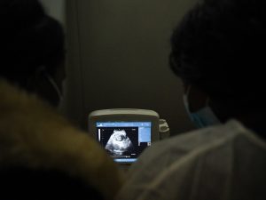 نزيف يكشف وجود جنين داخل معدة طفلة مصرية في حالة طبية نادرة